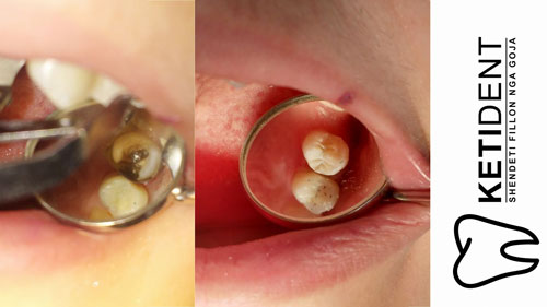 dental treatment 9