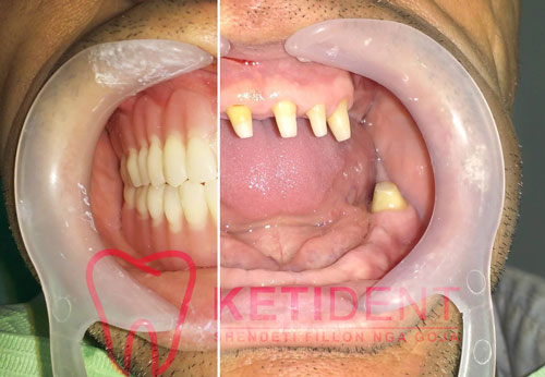 dental treatment 10
