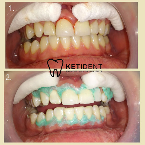 dental treatment 11