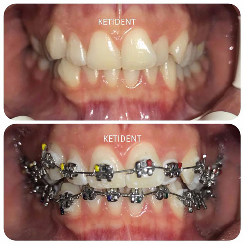 dental treatment 12