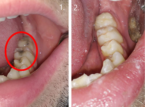 dental treatment 13