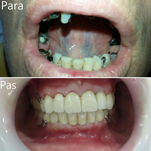 dental treatment 14
