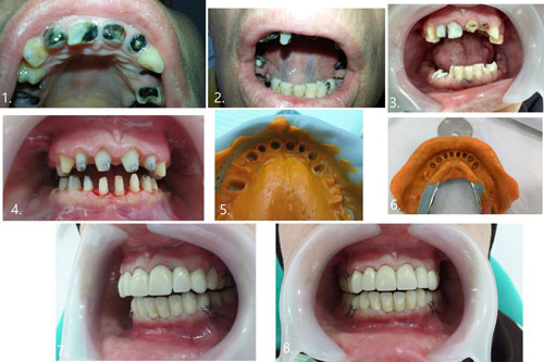 dental treatment 15