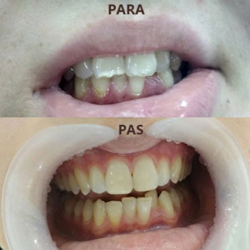 dental treatment 18