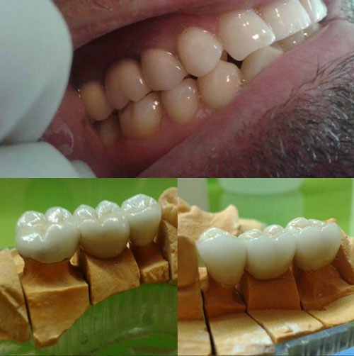 dental treatment 19