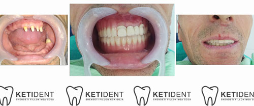 dental treatment 5