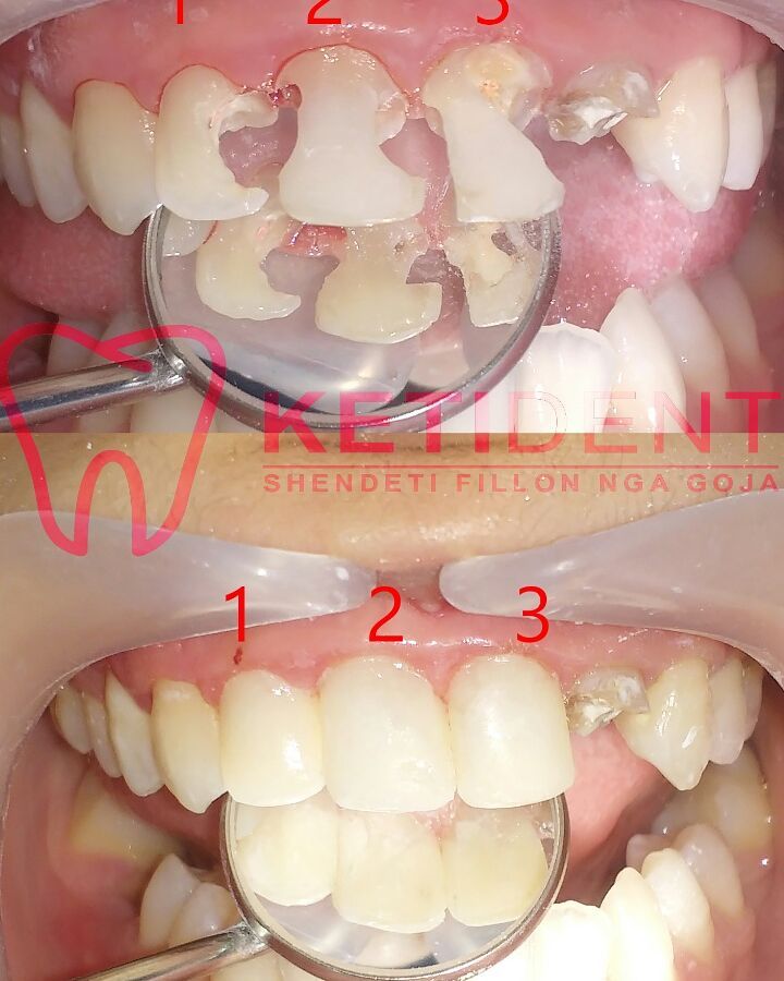 dental treatment 8